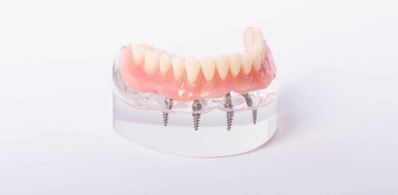 Kādi ir pieejamie protēžu veidi?